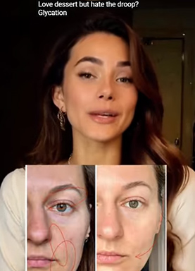 Video 3